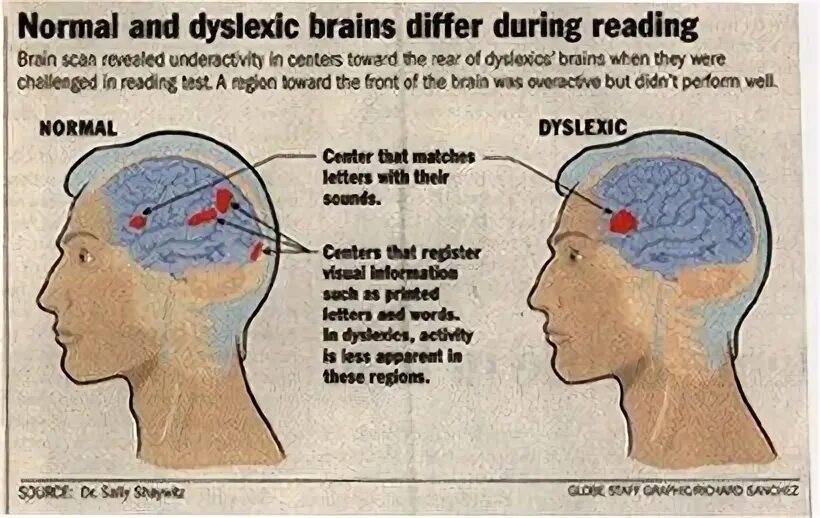 Reading in the brain. Мозг дислексика и обычного человека. how polyglots&#039; brains different.