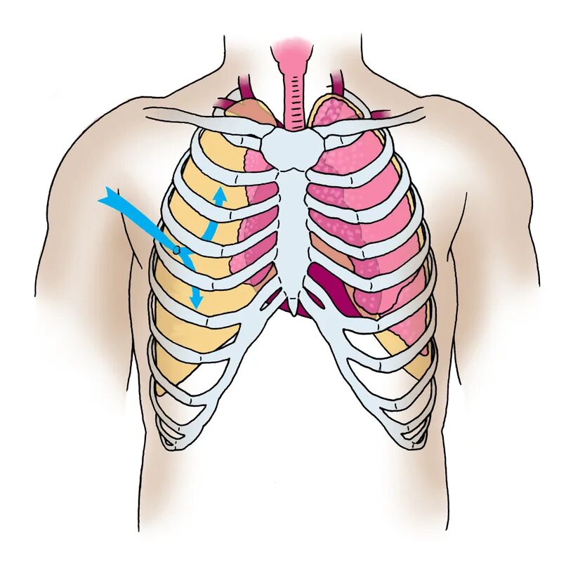 Расположение легких. Расположение лёгких в грудной клетке. Проекция ребер на грудную клетку. Местоположение легких