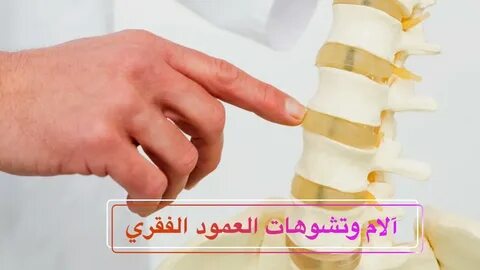 Отзывы имплантов позвоночника