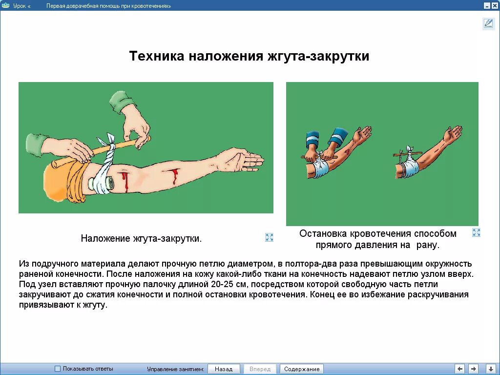 3 этапа оказания 1 помощи. Оказание первой помощи при кровотечении. Оказание первой помощи при артериальном кровотечении. Оказание 1 доврачебной помощи при кровотечениях. Алгоритм оказания помощи при артериальном кровотечении.