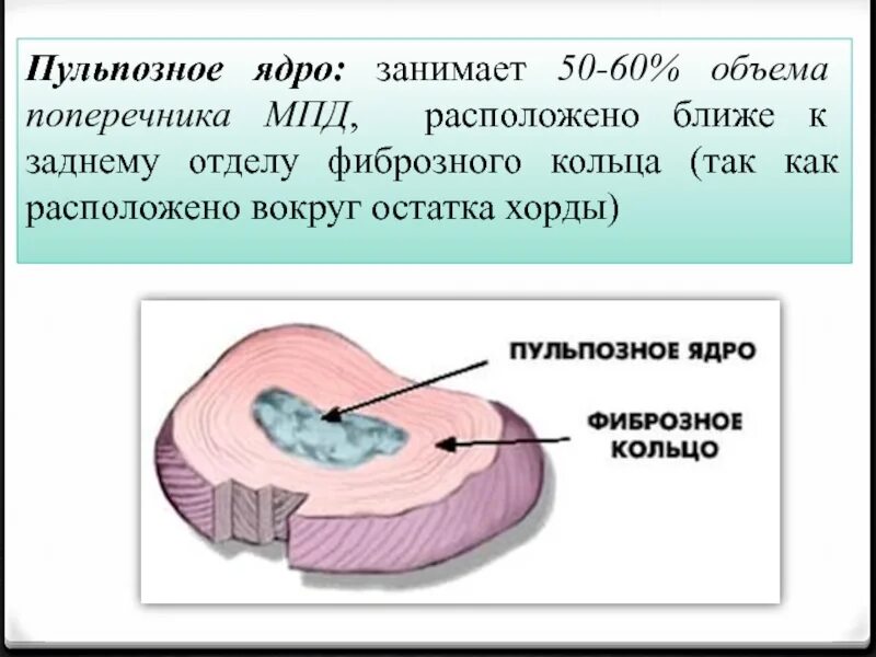 Ядер диск. Пульпозное ядро и фиброзное кольцо. пульпозное ядро. дегидратация пульпозного ядра. пульпозных ядер.