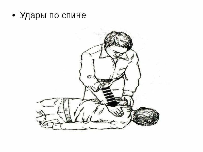 Ударил спину