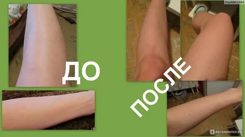 Через сколько можно загорать после лазерной