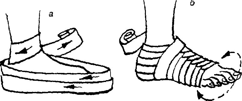Восьмиобразная повязка на стопу алгоритм. Десмургия повязка возвращающаяся на стопу. Наложение восьмиобразной повязки на голеностопный сустав. Алгоритм восьмиобразной повязки на голеностопный сустав. Какая повязка при повреждении голеностопного сустава