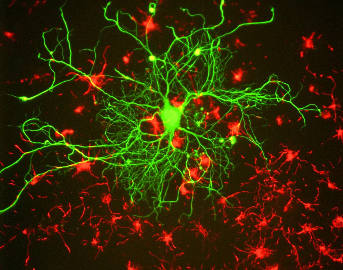 Флуоресцентная микроскопия Нейроны. Клетки головного мозга. Нейроны мозга под микроскопом. Люминесцентная (флуоресцентная) микроскопия.