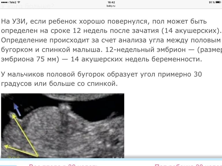 Узи беременность какой неделя можно. Определения пола ребенка на какое неделе УЗИ. УЗИ 12 недель определение пола. Пол на 12 неделе беременности по УЗИ. На какой неделе узнают пол ребенка.