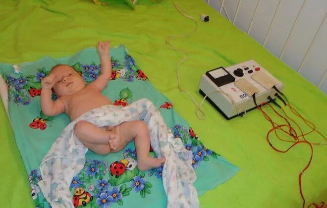 Физиотерапия для грудничка. Detei. Электростимуляция детей. Физиолечение электрофорез для детей. Физиотерапия для новорожденных.