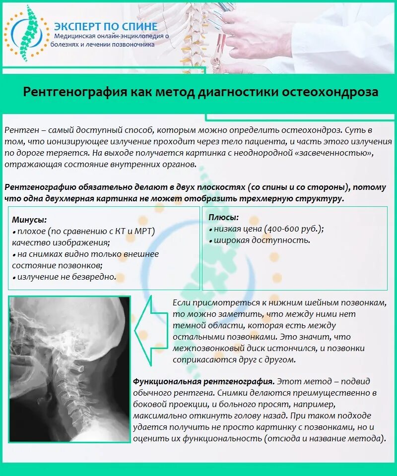 Диагностика остеохондроза позвоночника. Диагностика остеохондроза шейного отдела позвоночника. Шейный остеохондроз диагноз. Остеохондроз шейного отдела позвоночника диагно.