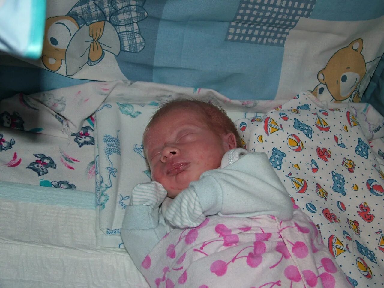 аллергия у новорожденных. неонатальный пустулез новорожденных. цветение новорожденных. что значит дети цветут новорожденные. микрогнатия у новорожденных.