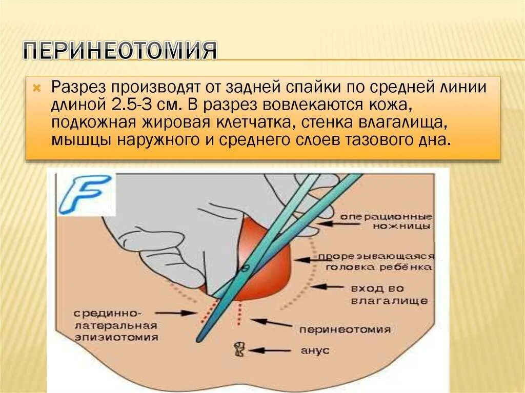 Может ли разойтись внутренний