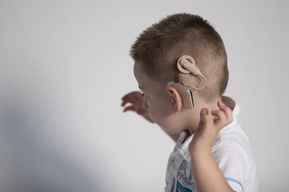 Кохлеарная имплантация Cochlear. Глухие и слабослышащие дети. Дети с кахлеарной имплантация. Нарушение слуха. Раз можно прослушать