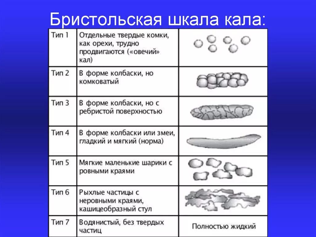 Тип 6 кала Бристольской шкале. Бристольская классификация формы кала. Бристольская шкала формы кала 4. Таблица кала Бристольская. Шкала кала по бристольской шкале