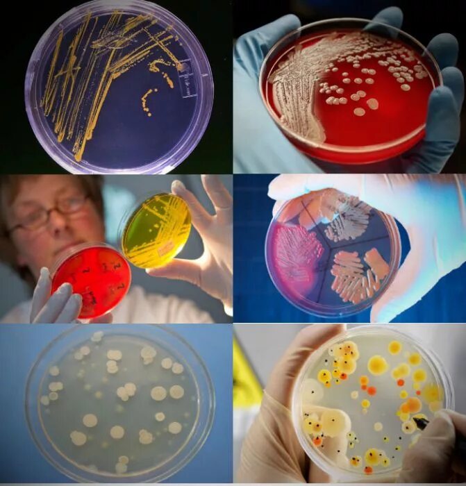 Питательные среды для культивирования микробов. Питательные среды для культивирования бактерий. Посев микроорганизмов на питательные среды. Посев на питательные среды микробиология. Микробиологические на аэробные микроорганизмы