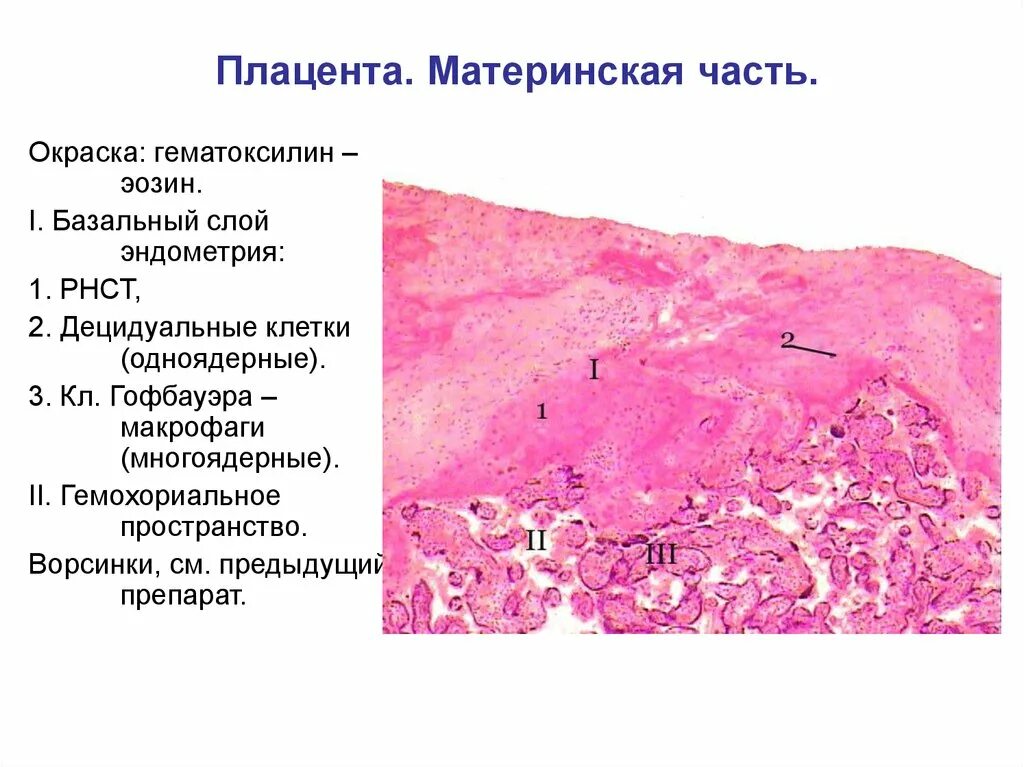 Гистология при беременности. Гематоксилин эозин гистология. Строение материнской части плаценты гистология. Плацента человека плодная часть гистология. Плацента человека плодная часть препарат гистология.