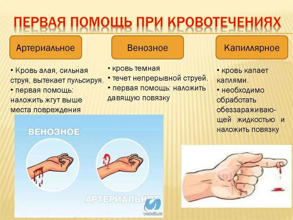 Оказание первой помощи остановки наружного кровотечения. Первая помощь при артериальном и венозном кровотечении. оказание первой доврачебной помощи при кровотечениях. оказание 1 помощи при артериальном и венозном кровотечении. основные приемы оказания первой помощи при кровотечении.