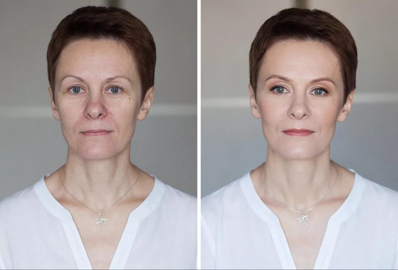 Изменения после 40 лет
