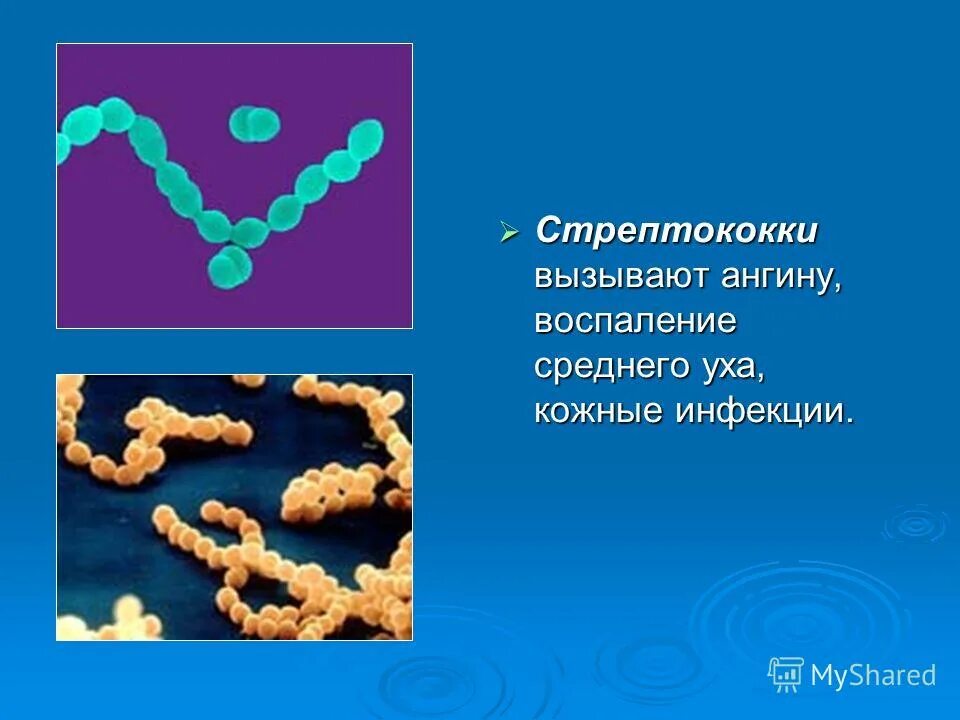 Микроорганизмы вызывающие заболевания называются. Ангтну вызывает бактерии. Бактерии вызывающие тонзиллит. Ангина возбудитель бактерия. Ангина бактерии вызывающие.