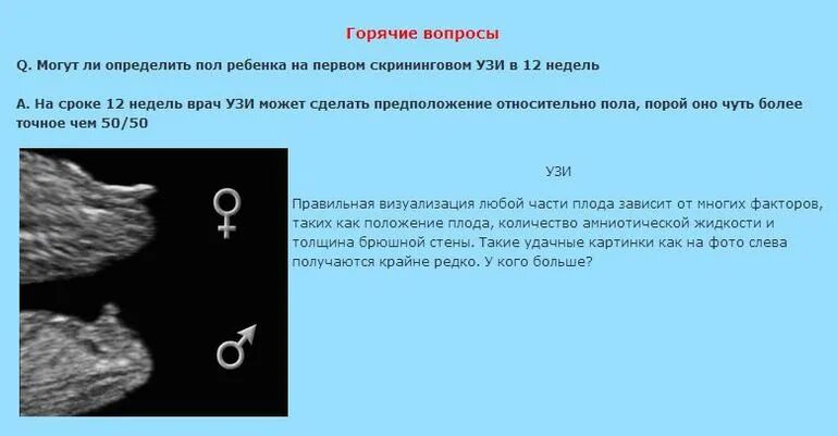 15 недели можно узнать пол. Определение пола ребенка на ранних сроках по узи. определение пола плода по узи на каком сроке. на каком сроке можно определить пол ребенка на узи. на коко с роки можна узнать поль ребенка.