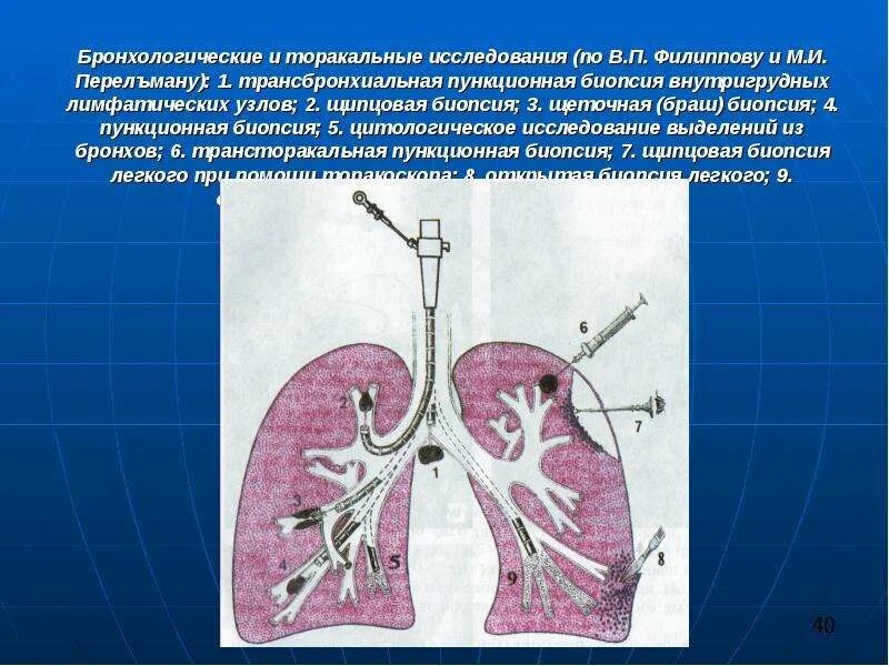 Чрескожная биопсия легких. Бронхоскопия туберкулез внутригрудных лимфатических узлов. Щеточная биопсия бронхов. Трансторакальная биопсия (для биопсии легкого).. Биопсия легких как проводится