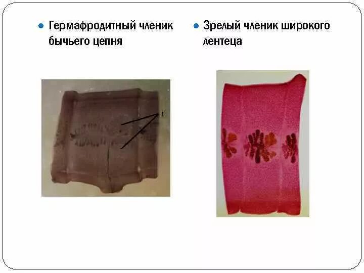 Проглоттида широкого лентеца. Гермафродитный членик бычьего цепня. гермафродитный членик лентеца. зрелый членик широкого лентеца препарат. гермафродитный и зрелый членик широкого лентеца.