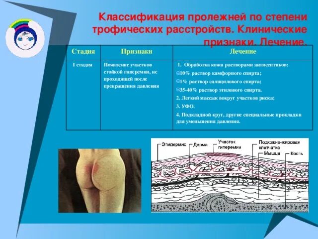 Факторы риска развития, места образования пролежней. Профилактика и лечение прол