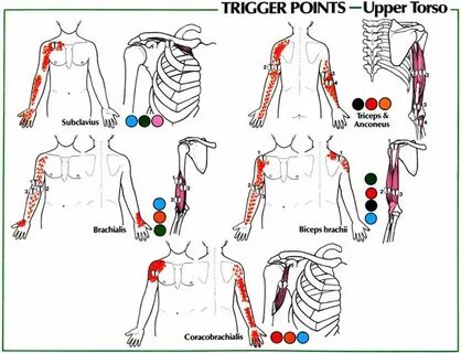 Trigger body