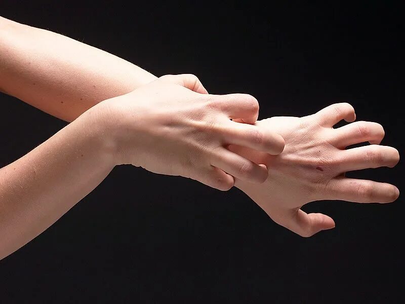 Замахивается рукой эмоции. Массаж рук. Драматичность с заламыванием рук. Гигиеническая обработка рук европейский стандарт en 1500. Массаж и самомассаж пальцев рук.