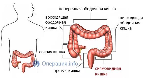 Поперечно-ободочная и сигмовидная кишка. Кишечник поперечно ободочная кишка. Печеночный изгиб ободочной кишки. Изгибы поперечной ободочной кишки. Сигма кишечника