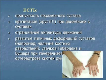 Костная крепитация при переломе