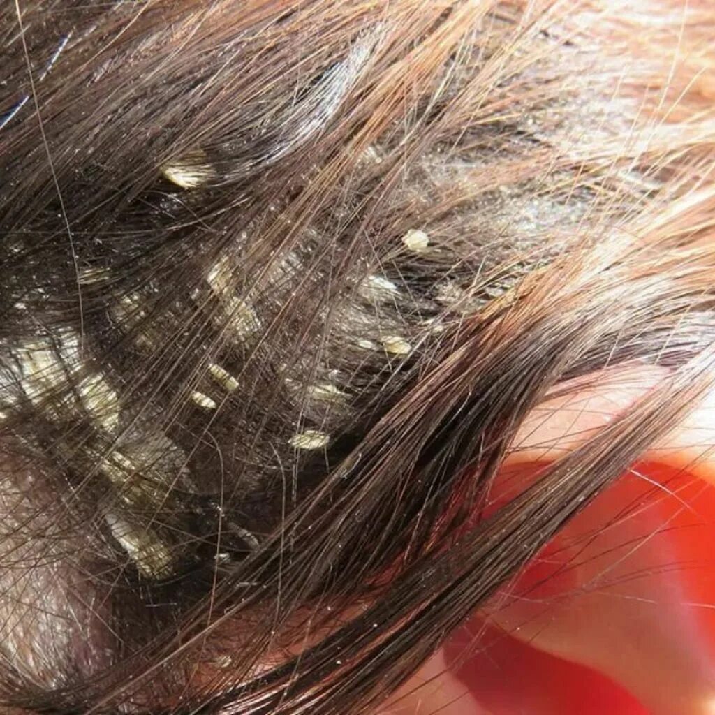 Pin on Lice mimics