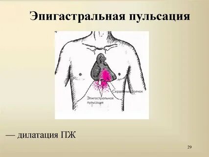 Эпигастральная связь
