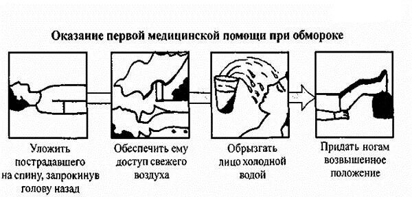 Доврачебная помощь при потере сознания. Оказание первой медицинской помощи при обмороке. правила оказания первой медицинской помощи при обмороке. последовательность оказания первой помощи при потере сознания. первая медицинская помощь при обмороке последовательность.