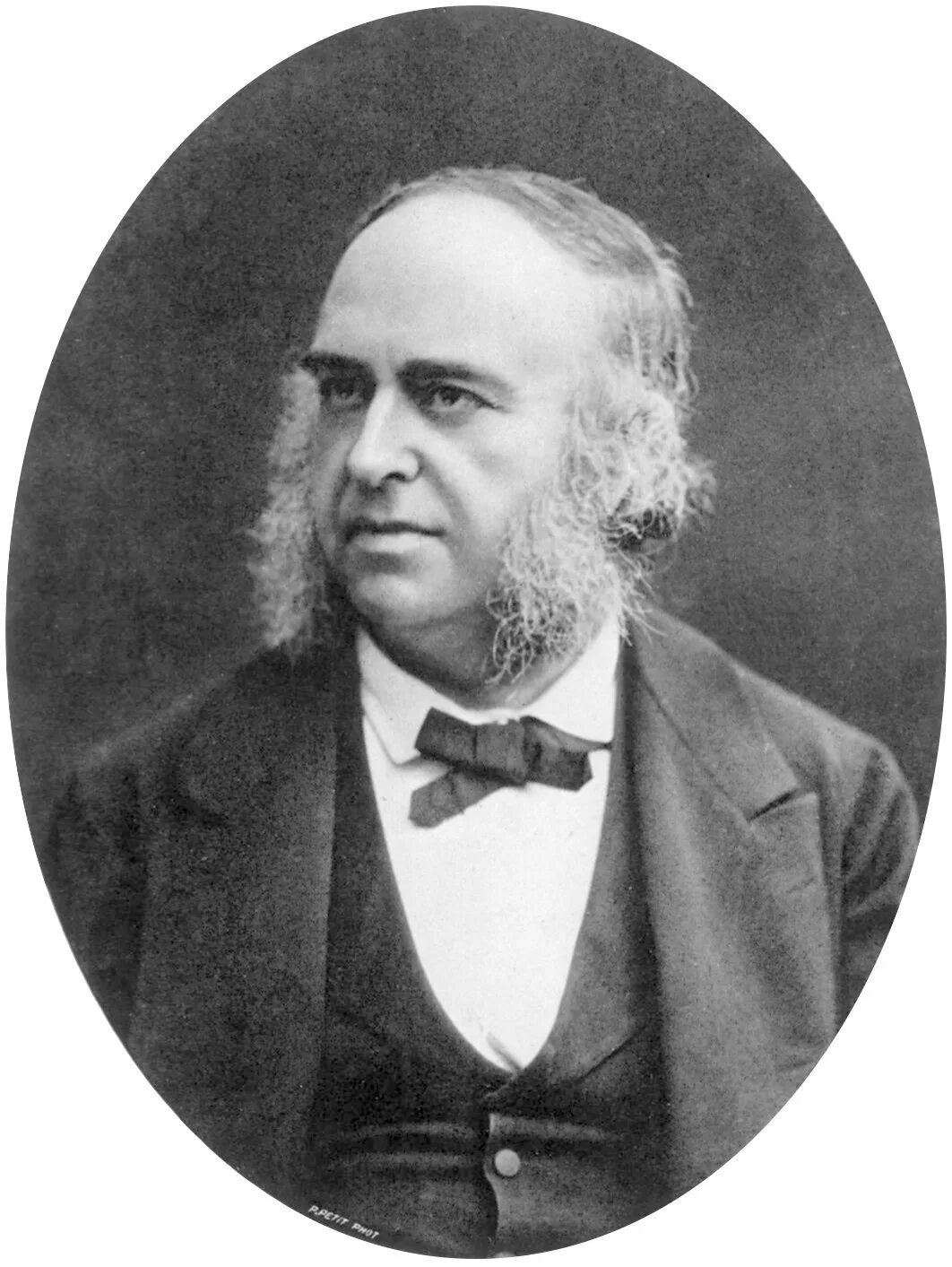 К д поль. Поль брока 1824-1880. пьер брока. поль брок. поль брока французский хирург.