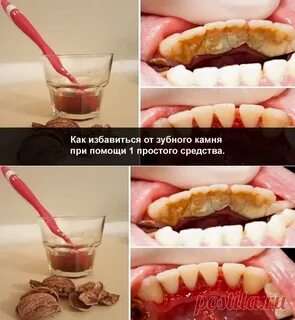 В том что можно самостоятельно