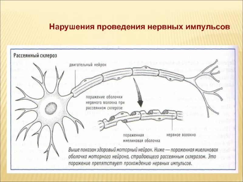 Путь передачи нервного импульса в мозг. Схема проведения нервного импульса. Нарушение передачи нервных импульсов. Схема передачи нервного импульса. Нервный Импульс схема.