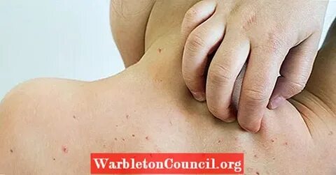 Мұзды кеудеге шомылу