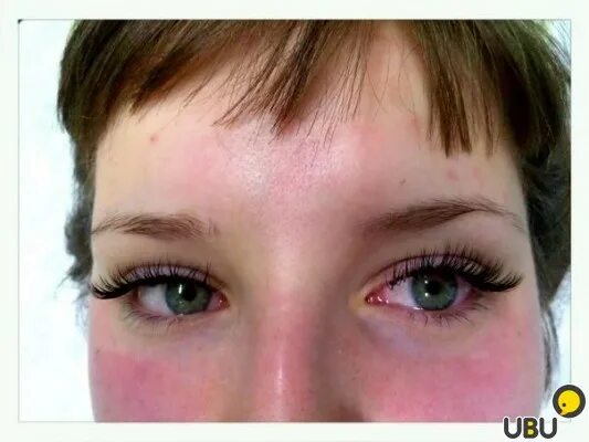 Аллергическая реакция на нарощенные ресницы. Реакция на нарощенные ресницы. Аллергия на глазах от наращивания ресниц. Может ли быть аллергия на наращивание ресниц. Может ли быть аллергия на наращивание ресниц.