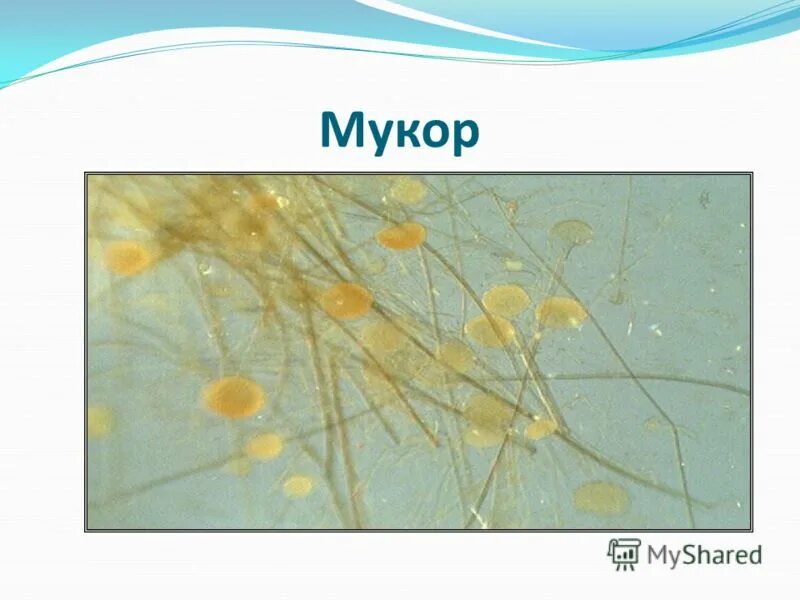 Мукор животное. Синцитий мукора. Клетка мукора. Гриб мукор. Строение мукора.