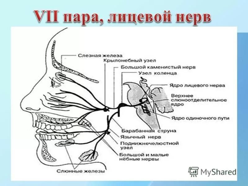 Карта лицевых нервов. Лицевой нерв схема пути. Ядра лицевого нерва схема. Лицевой нерв ядра топография. Лицевой нерв анатомия топография схема.