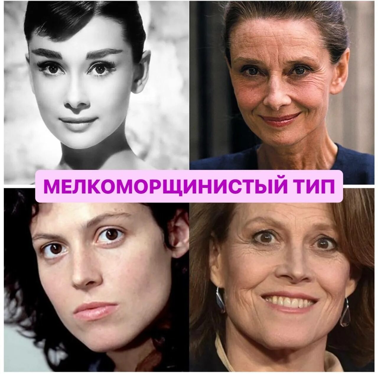 Тип старения примеры. Мелкоморщинистый тип старения кожи. мелкоморщинистый тип. типы старения. морфотипы старения лица.