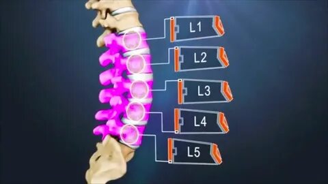 L1s2