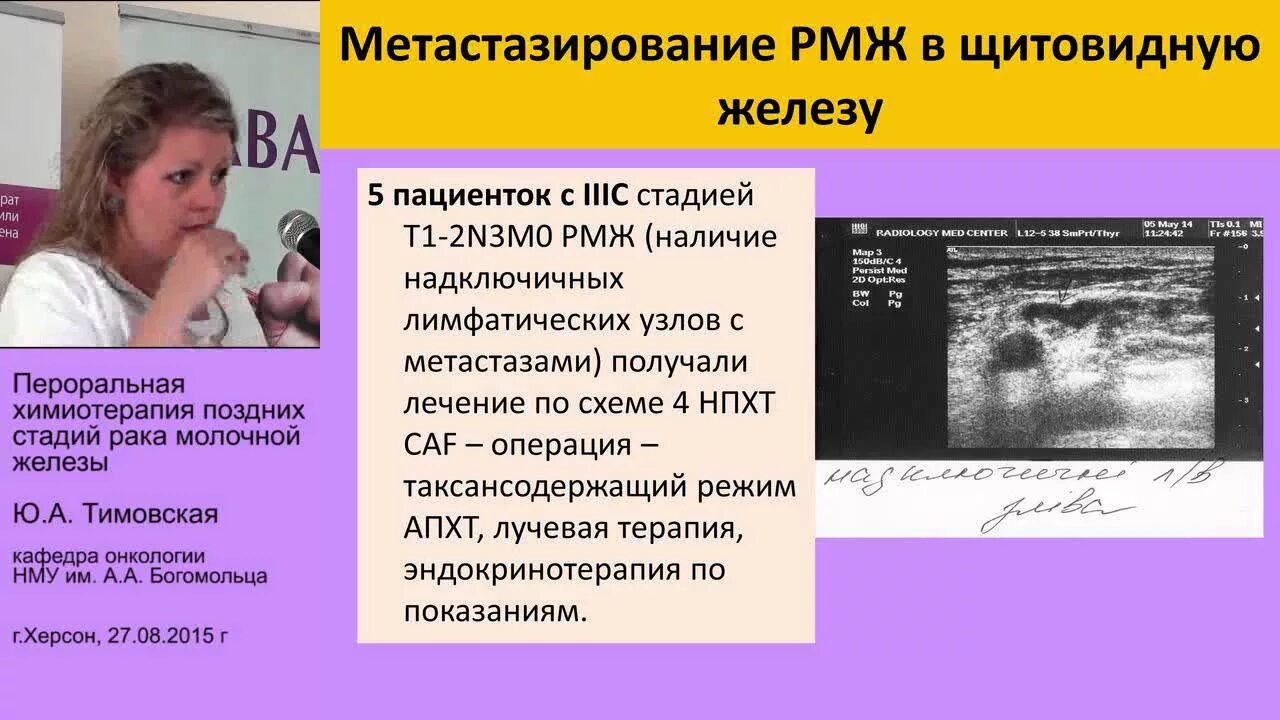 Красная химия при раке. Онкология 2 степень молочной железы. Химиотерапия молочной железы. Агрессивные типы РМЖ. Метастазирование после химиотерапии.