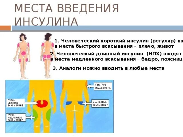 Схема введения инсулина длительного действия. Места введения инсулина схема. Места для введения короткого инсулина. Места введения инсулина в живот.