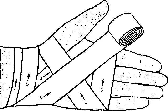 Повязка на руку схема. Крестообразная (восьмиобразная) повязка на кисть. Перевязка восьмиобразная лучезапястного сустава. Восьмиобразная повязка на лучезапястный сустав. Крестообразная повязка на лучезапястный сустав.