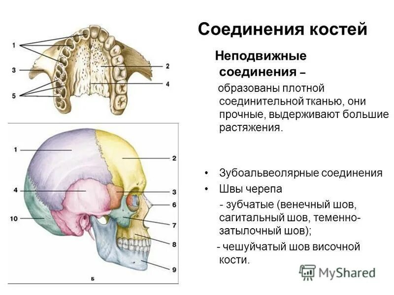 Теменная кость неподвижная. Соединение костей черепа анатомия. Соединения костей черепа швы роднички. Соединение костей мозгового отдела черепа.