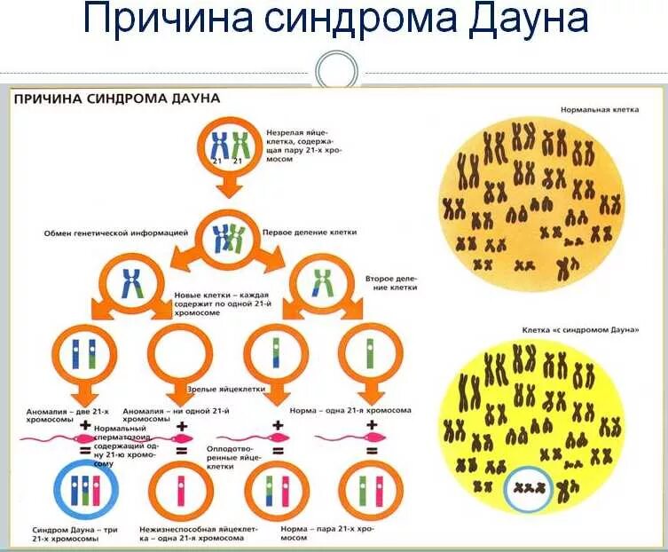 Основной причиной синдрома дауна является нарушение процесса. Механизм развития синдрома дауна. факторы развития синдрома дауна. генетический механизм патологии синдрома дауна. болезнь дауна причины.
