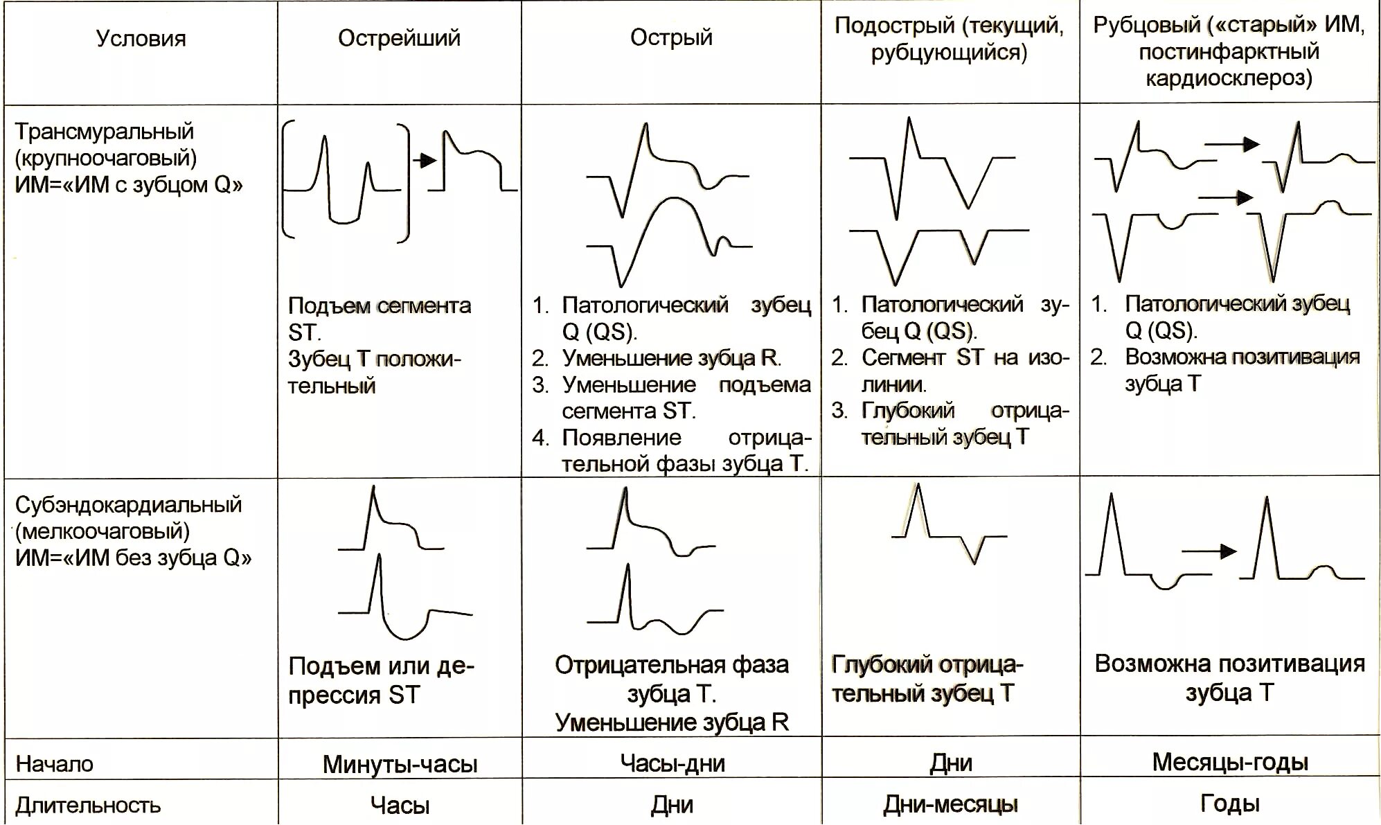 St ишемия. Инфаркт миокарда классификация ЭКГ. ЭКГ при ИБС: инфаркт миокарда, острый период. Схема ЭКГ при инфаркте миокарда. ЭКГ при ишемии передней стенки миокарда.