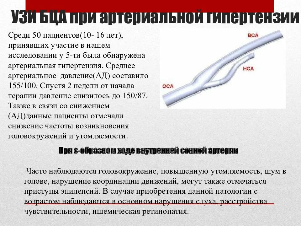 УЗИ брахиоцефальных артерий. Брахиоцефальные артерии УЗИ. Брациохифальные артерии УЗИ. УЗИ брахиоцефальных артерий патологии