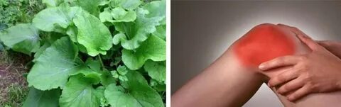 Лечение лопухом артроза коленного сустава