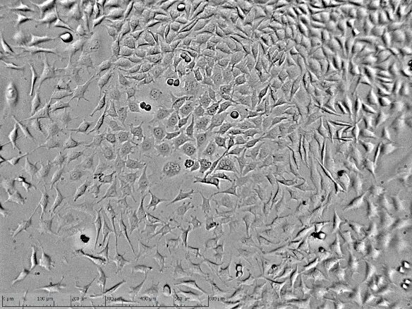 Mice cells. L929 клетки. Клеточная линия l 929. Д-929 Cell line. Микоплазменное поражение культуры клеток l929.